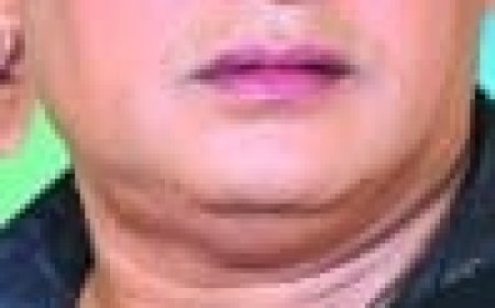 ଯାତ୍ରା କଳାକାର ଜିତେନ୍ଦ୍ରୀୟ ନାୟକଙ୍କୁ ଛୁରା ମାଡ଼