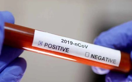 ଏହା ନୂଆ ଭାରିଆଣ୍ଟ ନୁହେଁ : ରାଜ୍ୟ ଜନସ୍ବାସ୍ଥ୍ୟ ନିର୍ଦ୍ଦେଶକ